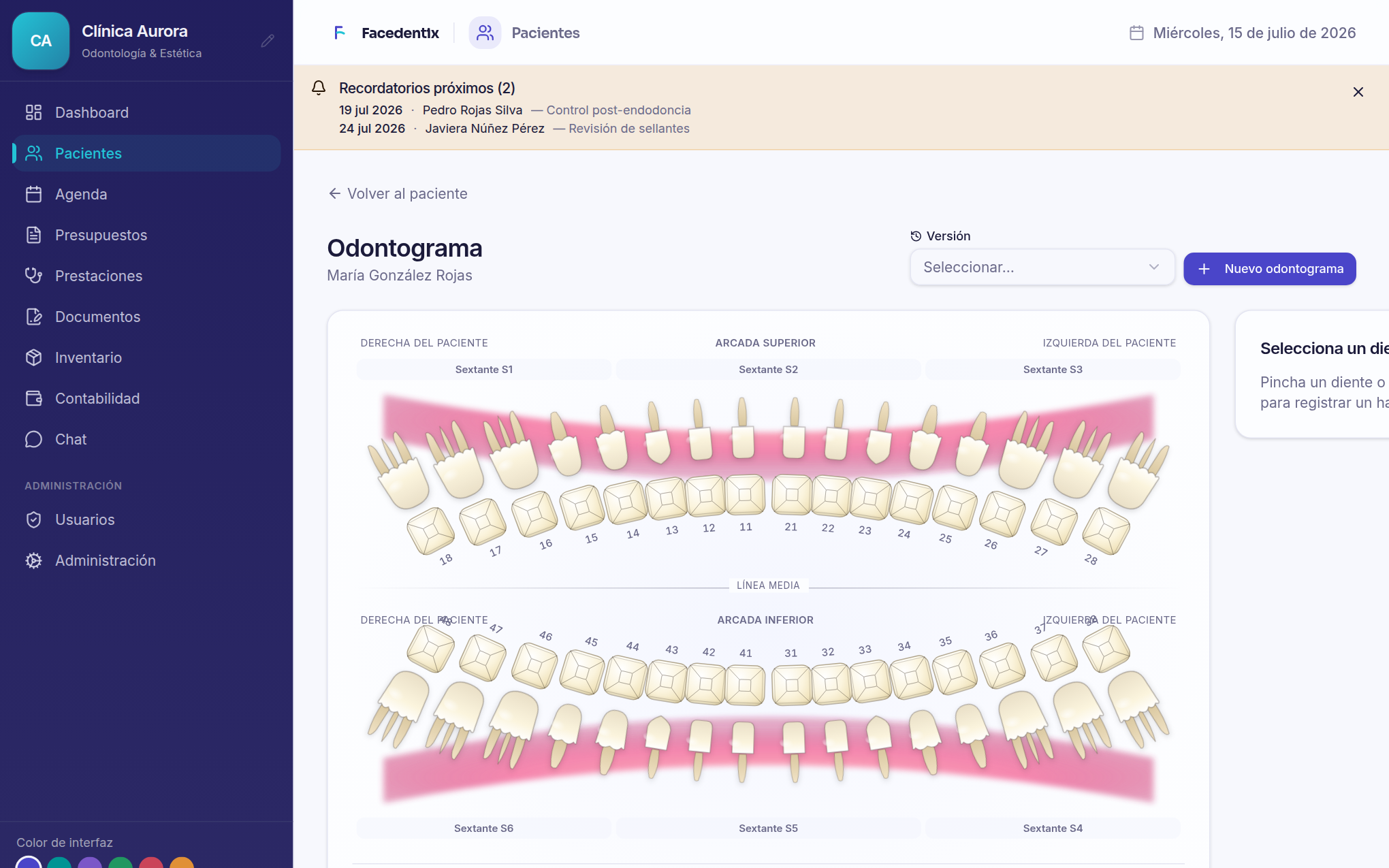 Odontograma digital de Facedentix: registro visual pieza por pieza con leyenda de hallazgos